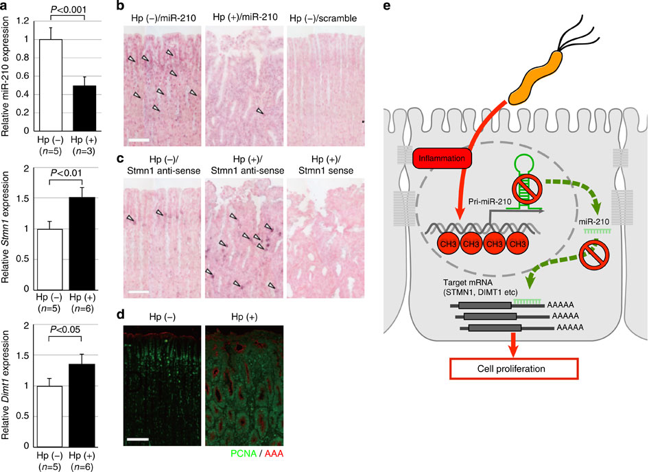 降低miR-210的表達與Stmn1水平的提高和幽門螺桿菌感染蒙古沙鼠增值相關標記有關。