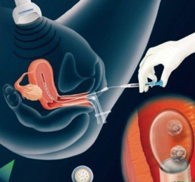 網友的血淚史：做試管嬰兒必經的7個坎